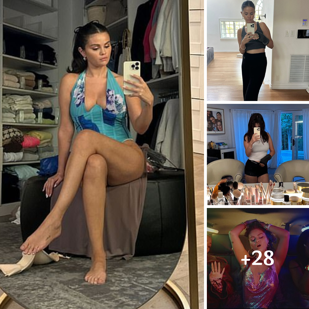 Selena Gomez shares swimsuit selfie on social media after revealing reason she’s wearing cast on her arm